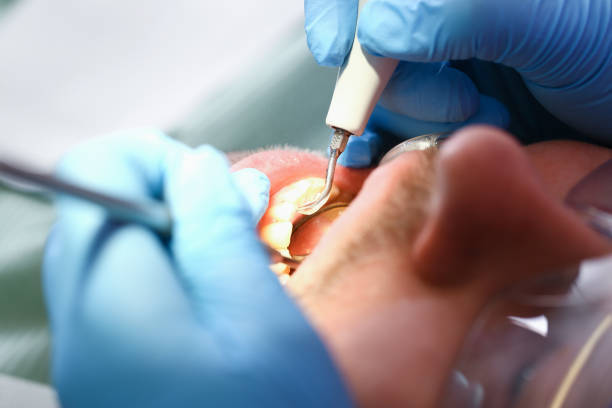 Best Emergency Dental Services for Seniors in Gadsden, AL