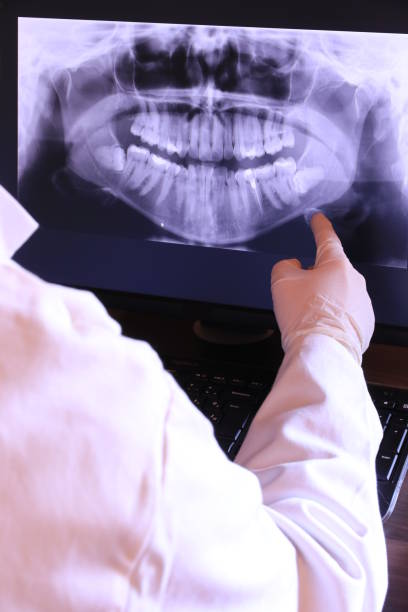 Best Emergency Dentist for Lost Fillings or Crowns in Gadsden, AL