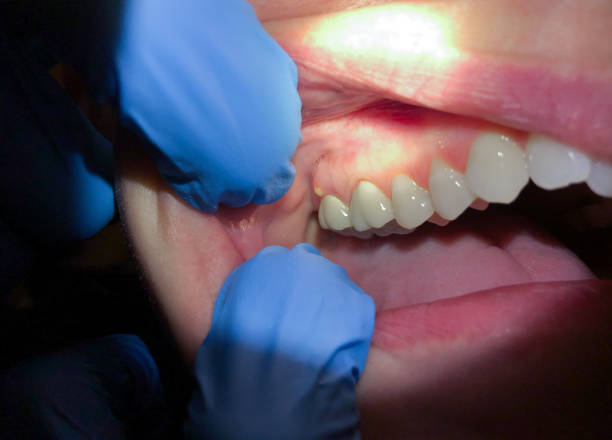 Best Mobile Emergency Dentist in Gadsden, AL